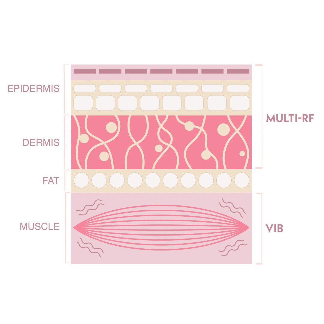 TriPollar STOP Vx 2 | FDA-Cleared At-Home RF Anti-Aging Device