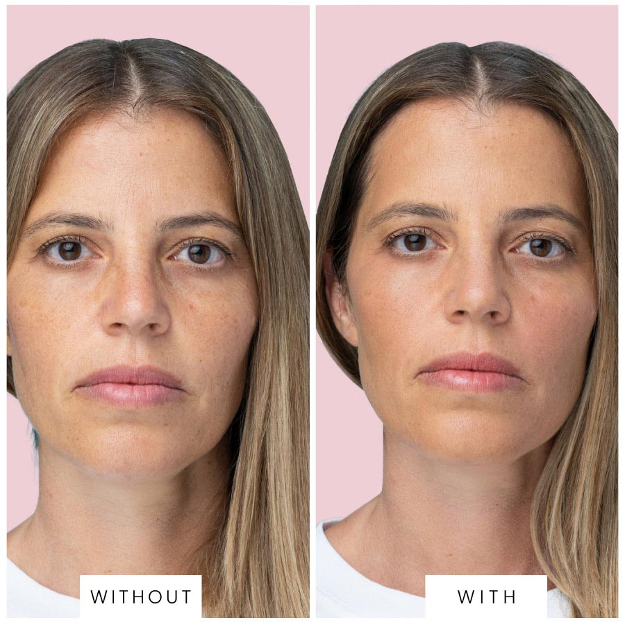 TRIPOLLAR stop Vx(トライポーラ ストップVx) TriPollar STOP Vx 2